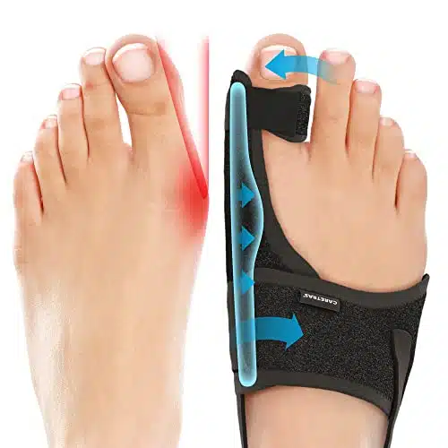 Caretras Bunion Corrector, Orthopedic Bunion Splint, Big Toe Separator Pain Relief, Non Surgical Hallux Valgus Correction, Hammer Toe Straightener, Day Night Support (Simple E